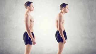 Posture & Muscle Imbalances