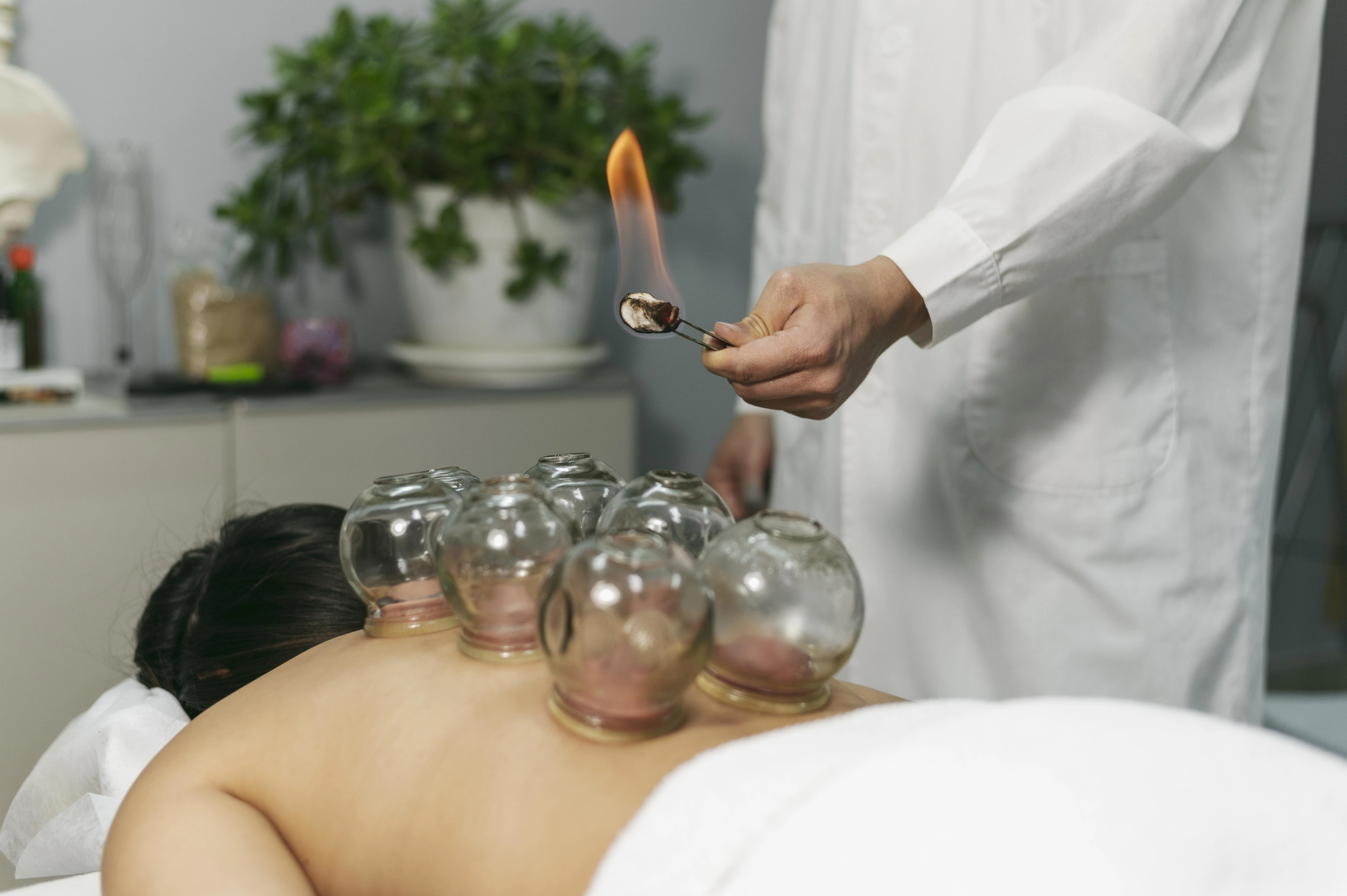 Hijamah Therapy Hero